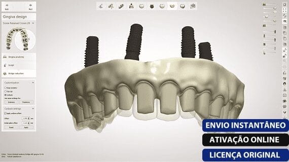 Software: Uma renderização digital de um modelo 3Shape Dental System - VITALÍCIO é exibida em uma tela, exibindo um design protético detalhado com parafusos. Sobreposições de texto destacam entrega instantânea, ativação online e licenciamento original — semelhante a comprar licença na sua loja de software preferida.