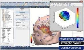 Software: Uma tela de computador exibe a interface MATLAB R2022a v9.12, apresentando um software de imagem cerebral 3D com várias opções de dados à esquerda e um modelo cerebral vibrante em uma janela separada à direita. Os rótulos na parte inferior destacam a entrega instantânea, ativação online, uma licença original e uma opção para comprar uma licença em nossa loja de software (comprar licença na nossa loja de software).